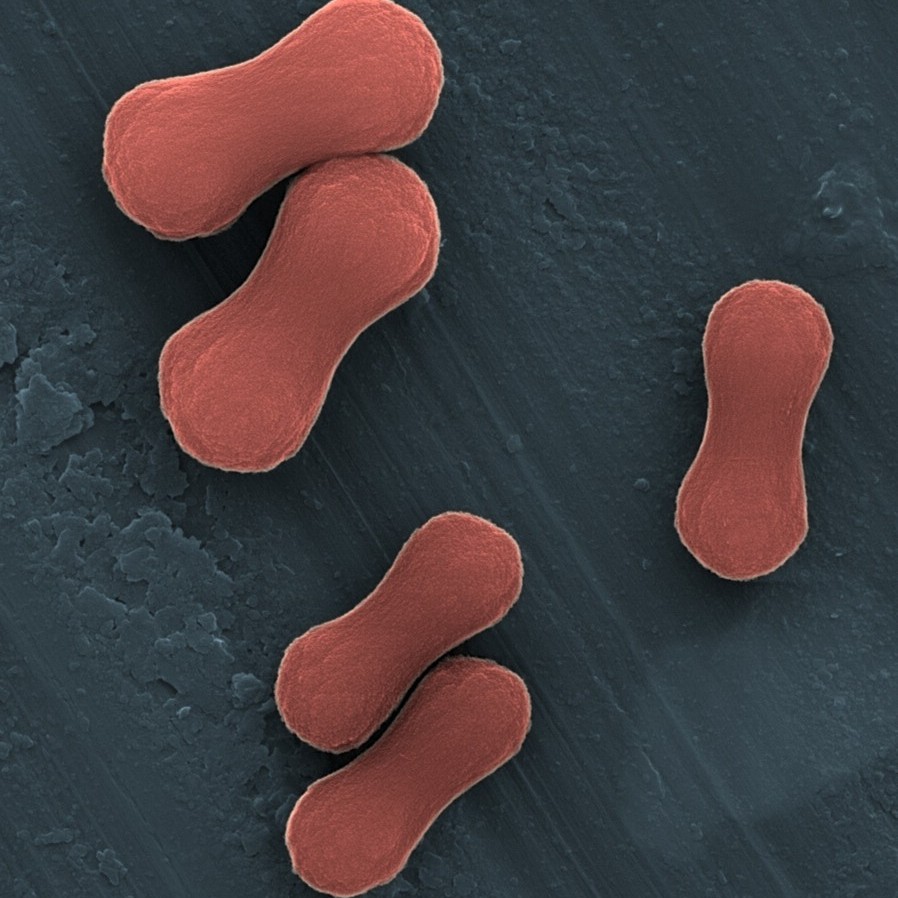Hematite Peanuts under SEM, colored post processing